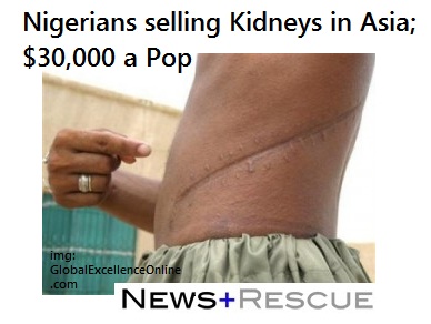 Nigerians Selling Their Kidney Online For $30,000 In Asia 5