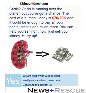 Nigerians Selling Their Kidney Online For $30,000 In Asia 1